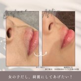 モアトゥインクル 福山神辺店(MORE twinkle)