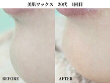 サンビ(SANBI)/化粧ノリが良くなる肌ケアはこれ