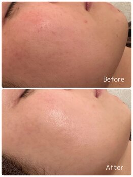 ククル(KUKULU)/ハーブ7回目♪(30代女性)