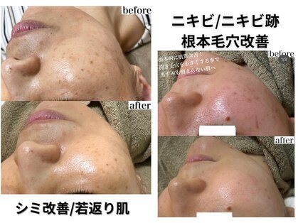 モンクラッシー(Mon classy)の写真