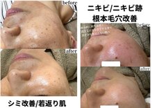 モンクラッシー(Mon classy)