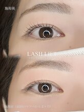 ジッピー オブ トータルビューティー アイエク(Zippy of totalbeauty iEQ)/