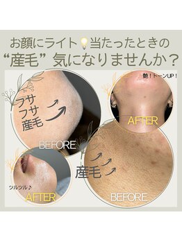 ジョエルワックス 沖縄那覇店(JOELLE WAX)/お顔の産毛気になりませんか？