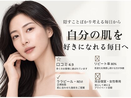 ソアスキン(SOAskin)の写真