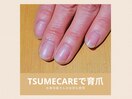 TSUMECAREで育爪☆