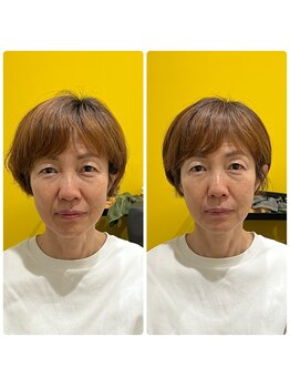 ウタタネ(utatane)/骨格補正