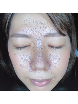 テセラ(Tethere)/毛穴