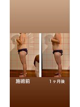 ココラボ(cocoLabo)/脂肪燃焼90分6回モニター様