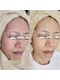 シェリーヌ(CherieNu)の写真/【結果重視のエンビロン】では様々な肌質や敏感肌にも対応★人気No.1の肌ケアです♪