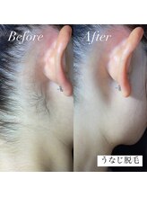 アース コアフュールボーテ 新潟紫竹山店(EARTH coiffure beaute)/うなじ脱毛