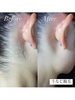 アース コアフュールボーテ 新潟紫竹山店(EARTH coiffure beaute)/うなじ脱毛