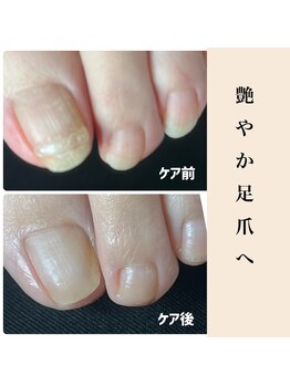 ユキネイル(YUKINAIL)/フットケア