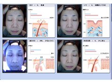 AI肌分析でパシャリ