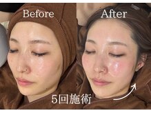 リネ(Rine)/透明感溢れるうるツヤ素肌に☆