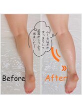 スリモア(SLIMORE)/ビフォーアフター☆足