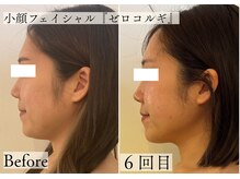 サロン カピリナ(salon Kapilina)の雰囲気（体重の増減なし！小顔・リフトアップ【お客様の口コミあり◎】）