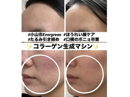 エバーグリーン(Evergreen)の写真