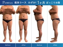 ピュアラ 心斎橋店/全身マシン痩身エンダモロジー