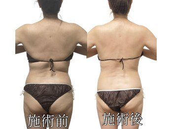 エリクシア 松戸/50代の方|全身痩身の施術症例