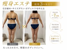 ポラス(Polus)の雰囲気（《本格痩身》結果にこだわりボディケアが得意なサロンです）