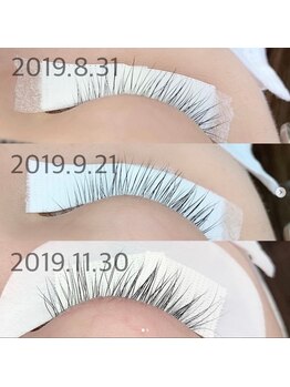 エステサロン ジョアアンジェ(joie ange)/幹細胞1100円でオプションあり