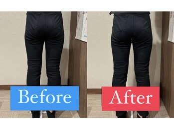 ナオル整体 宮崎院(NAORU整体)/20代女性施術事例【産後の歪み】