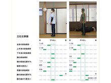 アロゼ/AIを使った姿勢分析