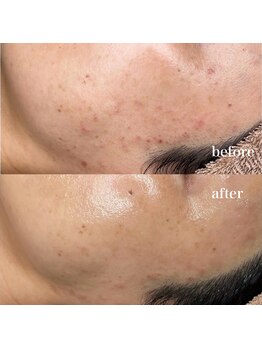 ルミナス(Luminous)/ララピール