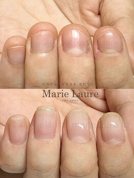マリーロール 淀屋橋本店(Marie Laure)/自爪育成/深爪矯正/ネイルケア