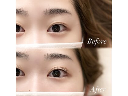 ラフレ(Rafre)の写真