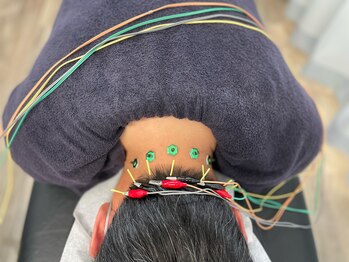 神谷澤鍼灸整骨院/鍼灸/はりきゅう