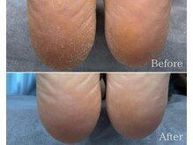 カシェット 広島店(Cachette)/40代女性☆足裏角質ケア90分