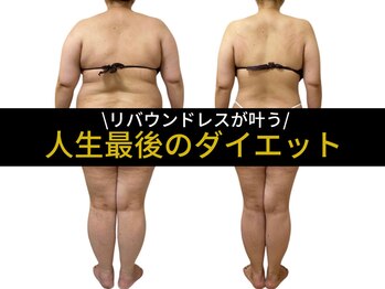 ジャジャン 福岡香椎店(jajan)の写真/落ちにくい年齢肉に！全身の筋膜癒着を剥がして骨格から変わる美シルエットへ
