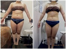 パーフェクトボディプレミアム 札幌大通店(PERFECT BODY PREMIUM)/お客様　ビフォーアフター（13）