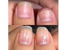 コンプレックスが自信に