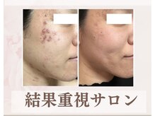 ソワン(Vi Soin)の雰囲気（ヒト幹細胞を使ったお手入れを是非お試し下さい。）