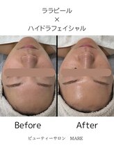 マーレ(MARE)/ハイドラネオ×ララピール