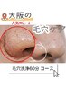 【通い放題専用】毛穴洗浄＋小顔＋ドライヘッドスパ付きコース30日間通い放題