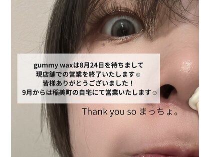 ガミーワックス(gummy wax)の写真