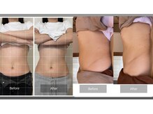 腸もみセラピー。体の内側から不調を改善◎