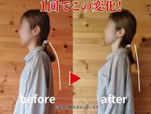 メリッサ接骨 整体院