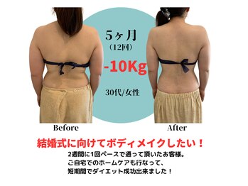 ベル(BeL)/筋膜リリース×痩身【5ヶ月】