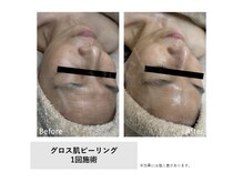 モイ(Moi’e)/シワ・リフトアップ・ツヤ肌