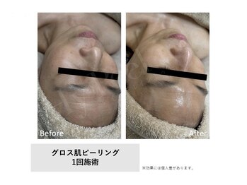 モイ(Moi’e)/シワ・リフトアップ・ツヤ肌