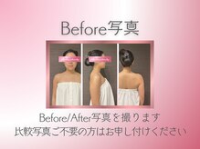 リス ブラン ビューティー(Lys blanc beauty)/BEFORE写真 