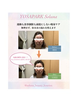 ヨサパーク ソルナ(YOSA PARK Soluna)/小顔効果も◎