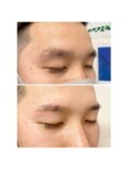 アイビー 神保町店(i.b)/眉【before⇒after】69