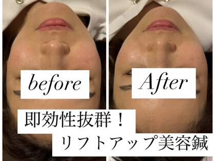 ユアン(YUAN)の写真