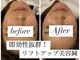 ユアン(YUAN)の写真
