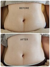 ラプタス(Rapu+)/お腹のむくみがスッキリ